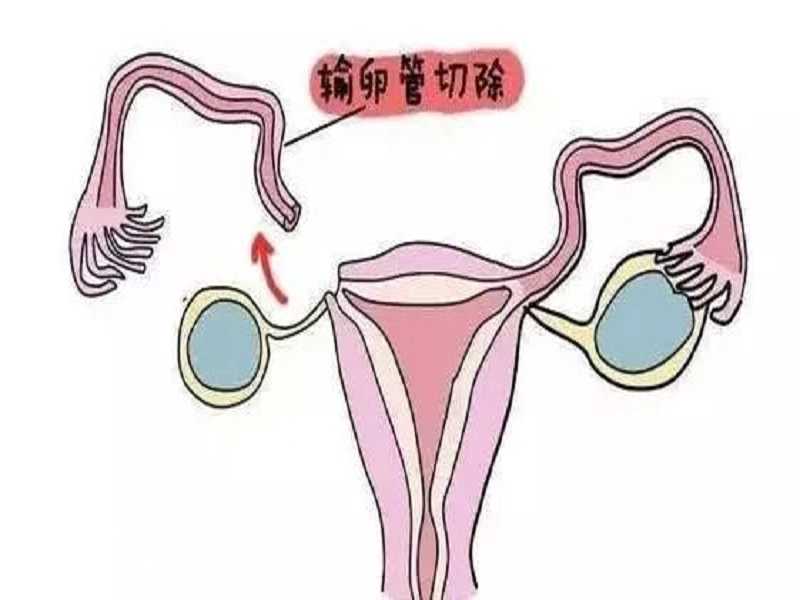 浙江有没有做试管婴儿医院，南京第一人民医院有精子库吗